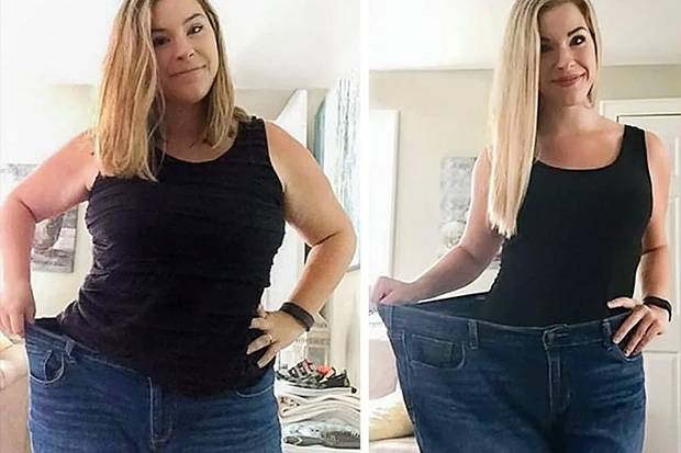 Zdjęcie po kuracji oschudzającej