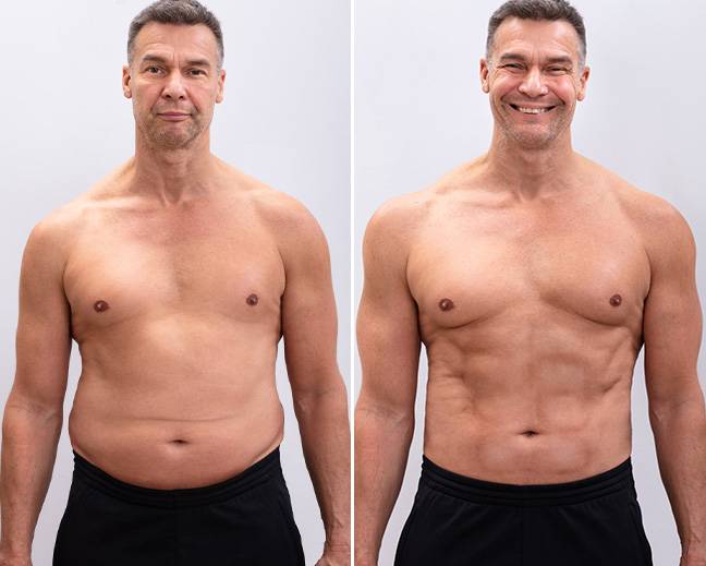 Zdjęcie po kuracji oschudzającej